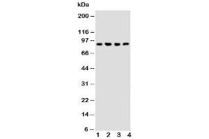 Western blot testing of NRG2 antibody and Lane 1:  rat liver (Neuregulin 2 Antikörper  (Middle Region))