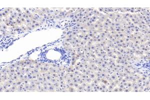 Immunohistochemistry (IHC) image for anti-Glucokinase (Hexokinase 4) Regulator (GCKR) (AA 90-286) antibody (ABIN7442180)