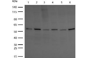 All lanes : CBX2 Rabbit mAb at 1/1k dilution Lane 1 : Hela whole cell lysates Lane 2 : SH-SY5Y whole cell lysates Lane 3 : MCF7 whole cell lysates Lane 4 : 3T3 whole cell lysates Lane 5 : C6 whole cell lysates Lane 6 : Rat Brain lysates Lysates/proteins at 20 μg per lane. (Rekombinanter CBX2 Antikörper)
