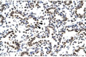 Human Lung; ZNF385 antibody - N-terminal region in Human Lung cells using Immunohistochemistry (ZNF385A Antikörper  (N-Term))