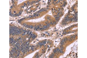 Immunohistochemistry (IHC) image for anti-S100 Calcium Binding Protein A13 (S100A13) antibody (ABIN2428683) (S100A13 Antikörper)