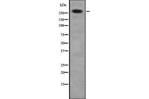 Western blot analysis of DSP using HuvEc whole cell lysates (Desmoplakin Antikörper  (C-Term))