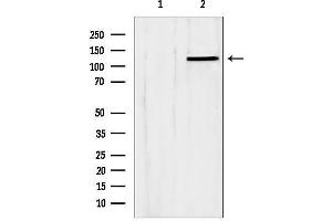 Western blot analysis of lysates from Hela, using SLC24 Antibody.