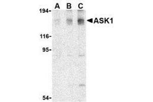 Western blot analysis of ASK1 in SW1353 cell lysate with AP30086PU-N ASK1 antibody at (A) 0. (ASK1 Antikörper)