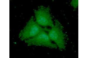 anti-Poly (ADP-Ribose) Polymerase 2 (PARP2) (AA 233-583) antibody