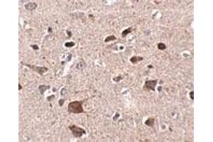 Immunohistochemistry of CCDC134 in human brain tissue with CCDC134 antibody at 2. (CCDC134 Antikörper  (N-Term))