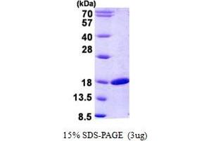 SDS-PAGE (SDS) image for Retinol Binding Protein 2, Cellular (RBP2) (AA 1-134) protein (His tag) (ABIN5852924)