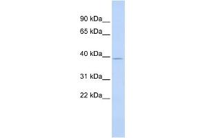 WB Suggested Anti-SAMD8 Antibody Titration: 0. (SAMD8 Antikörper  (Middle Region))
