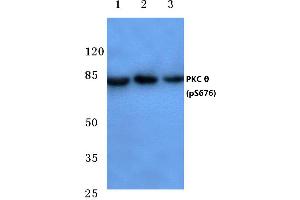 Western blot (WB) analysis of p-PKC ζ antibody at 1/500 dilution (PKC theta Antikörper  (pSer676))