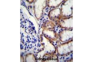 COL8A2 Antibody (C-term) immunohistochemistry analysis in formalin fixed and paraffin embedded human kidney tissue followed by peroxidase conjugation of the secondary antibody and DAB staining. (COL8a2 Antikörper  (C-Term, Chain alpha 2))