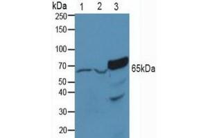 Figure. (PAK1 Antikörper  (AA 252-501))