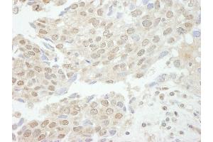Immunohistochemistry (IHC) image for anti-Tyrosyl-DNA Phosphodiesterase 1 (TDP1) (AA 1-50) antibody (ABIN7448828)