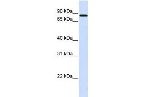 WB Suggested Anti-MAP4K2 Antibody Titration:  0. (MAP4K2 Antikörper  (N-Term))