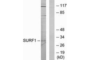 Western blot analysis of extracts from Jurkat cells, using SURF1 Antibody.