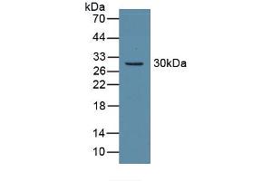Western blot analysis of recombinant Mouse CA2. (CA2 Antikörper)