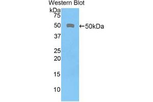 Western blot analysis of the recombinant protein. (CD46 Antikörper  (AA 136-341))