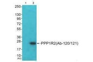 Western blot analysis of extracts from JK cells (Lane 2), using PPP1R2 (Ab-120/121) antiobdy. (PPP1R2 Antikörper  (Ser120, Ser121))