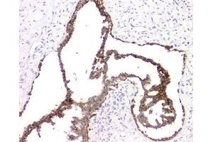 IHC analysis of RMI2 using anti-RMI2 antibody (ABIN6719656).