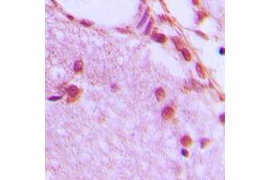 Immunohistochemical analysis of hnRNP H staining in human brain formalin fixed paraffin embedded tissue section. (HNRNPH1 Antikörper  (Center))