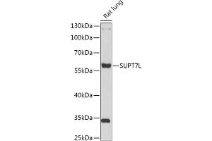 Western blot analysis of extracts of Rat lung, using SUPT7L antibody (ABIN7270646) at 1:1000 dilution. (SUPT7L Antikörper  (AA 210-400))