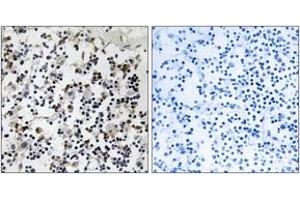 Immunohistochemistry analysis of paraffin-embedded human lymph node tissue, using CLIC4 Antibody. (CLIC4 Antikörper  (AA 1-50))