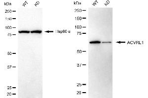 Western blotting analysis using ACVRL1 antibody (ABIN7797490).