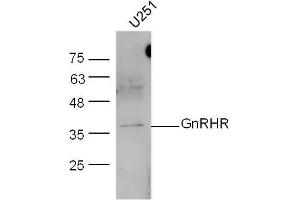U251 lysates probed with GnRHR Polyclonal Antibody, unconjugated  at 1:300 overnight at 4°C followed by a conjugated secondary antibody at 1:10000 for 60 minutes at 37°C. (GNRHR Antikörper  (AA 201-328))