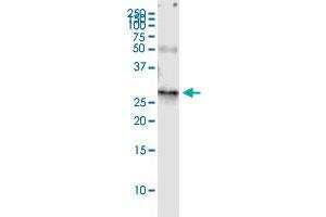 Immunoprecipitation of RAB32 transfected lysate using rabbit polyclonal anti-RAB32 and Protein A Magnetic Bead ( U0007 ), and immunoblotted with mouse purified polyclonal anti-RAB32. (RAB32 (Human) IP-WB Antibody Pair)