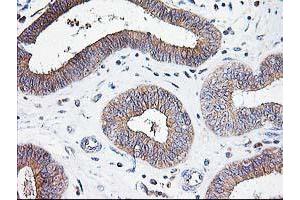 Image no. 1 for anti-ATG3 Autophagy Related 3 (ATG3) antibody (ABIN1496760) (ATG3 Antikörper)