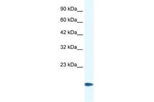 Western Blotting (WB) image for anti-Cysteine and Glycine-Rich Protein 3 (CSRP3) antibody (ABIN2460883) (CSRP3 Antikörper)