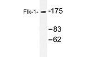 Western blot analysis of Flk-1 antibody in extracts from HepG2 cells. (VEGFR2/CD309 Antikörper)
