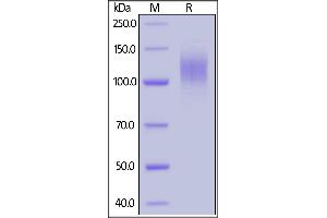 2019-nCoV S1 protein, His Tag on SDS-PAGE under reducing (R) condition. (SARS-CoV-2 Spike S1 Protein (His tag))