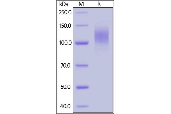 SARS-CoV-2 Spike S1 Protein (His tag)