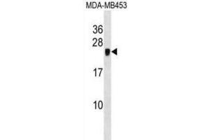 Western Blotting (WB) image for anti-Cysteine-Rich Protein 2 (CRIP2) antibody (ABIN2998781) (CRIP2 Antikörper)