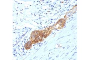 Formalin-fixed, paraffin-embedded human colon stained with anti-CD56 antibody (SPM489) (Neurofilament Antikörper  (Extracellular Domain))