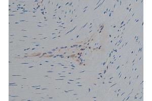 Immunohistochemistry (IHC) image for anti-phospholipase C, gamma 1 (PLCG1) (pTyr771) antibody (ABIN6256799)
