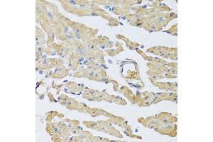 Immunohistochemistry of paraffin-embedded mouse heart using UCN2 antibody at dilution of 1:100 (40x lens). (Urocortin 2 Antikörper)