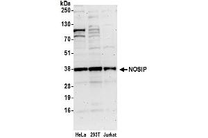 anti-Nitric Oxide Synthase Interacting Protein (NOSIP) (AA 100-150) antibody