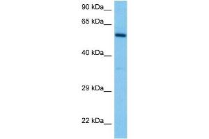 Host:  Mouse  Target Name:  DAB2  Sample Tissue:  Mouse Spleen  Antibody Dilution:  1ug/ml (DAB2 Antikörper  (N-Term))