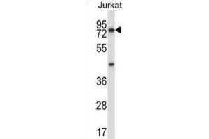 Western Blotting (WB) image for anti-Mucolipin 1 (MCOLN1) antibody (ABIN2997394)