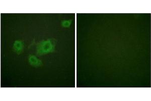 Immunofluorescence analysis of HuvEc cells, using Kir6. (KCNJ11 Antikörper  (pThr224))