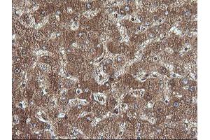 Image no. 1 for anti-Cancer/testis Antigen 1B (CTAG1B) antibody (ABIN1499896) (CTAG1B Antikörper)