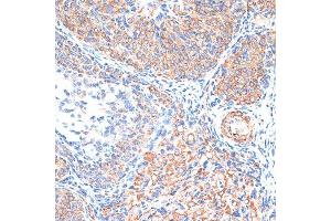Immunohistochemistry of paraffin-embedded Rat ovary using TIMP2 antibody (ABIN7268483) at dilution of 1:100 (40x lens). (TIMP2 Antikörper  (AA 100-200))
