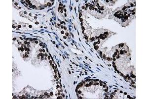 Image no. 16 for anti-Replication Protein A2, 32kDa (RPA2) antibody (ABIN1500733)