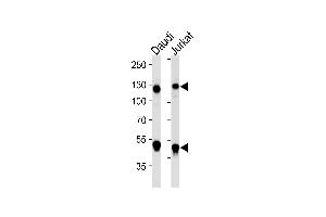 Western Blotting (WB) image for anti-Nuclear Factor of kappa Light Polypeptide Gene Enhancer in B-Cells 1 (NFKB1) antibody (ABIN1882050)