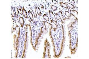 IHC analysis of PTBP1 using anti-PTBP1 antibody (ABIN7599450). (PTBP1 Antikörper  (AA 1-504))