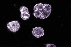 Immunofluorescent staining on SW-13 cells.