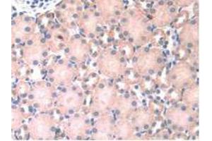 IHC-P analysis of Mouse Kidney Tissue, with DAB staining. (HPSE Antikörper  (AA 280-412))