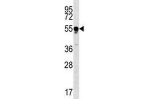 TUBB4Q antibody western blot analysis in Jurkat lysate. (TUBB4Q Antikörper  (AA 64-93))