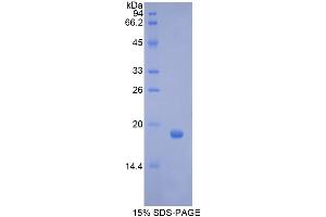 SDS-PAGE analysis of Pig GCSF Protein. (G-CSF Protein)
